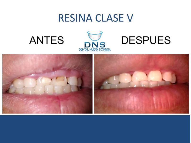 Dental Nueva Sonrisa 