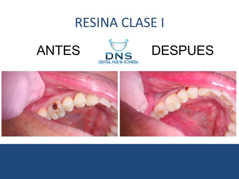 Dental Zihuatanejo 