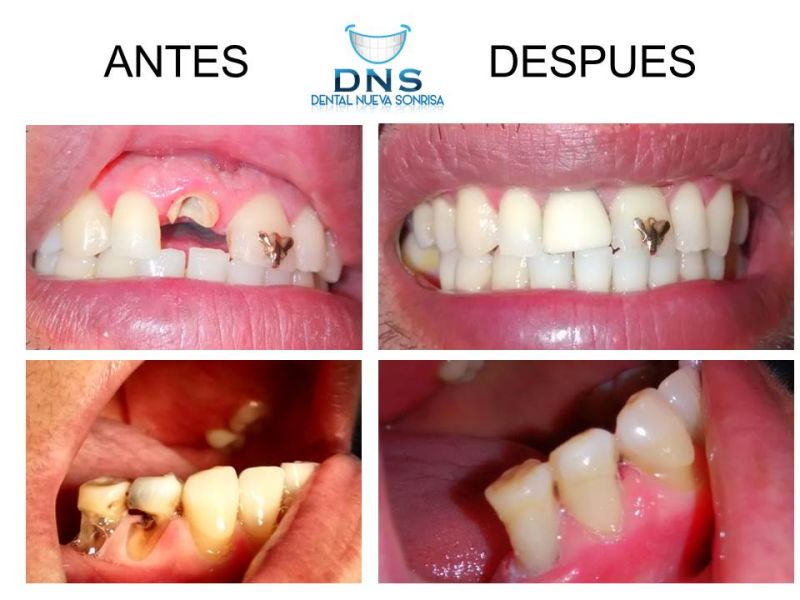 Dentista Zihuatanejo 