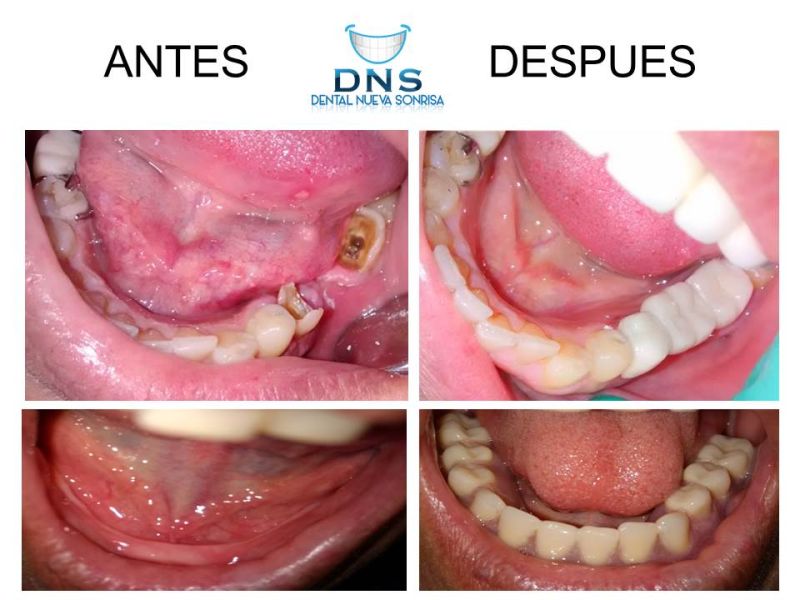 Dns Zihuatanejo 