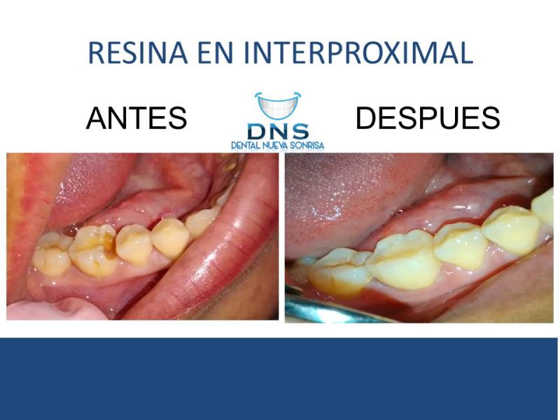 Nueva Sonrisa Zihuatanejo 