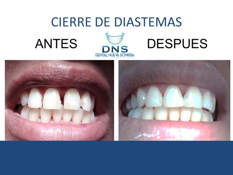 Servicio Dental Zihuatanejo 