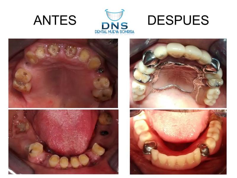 Tratamiento Dentista 